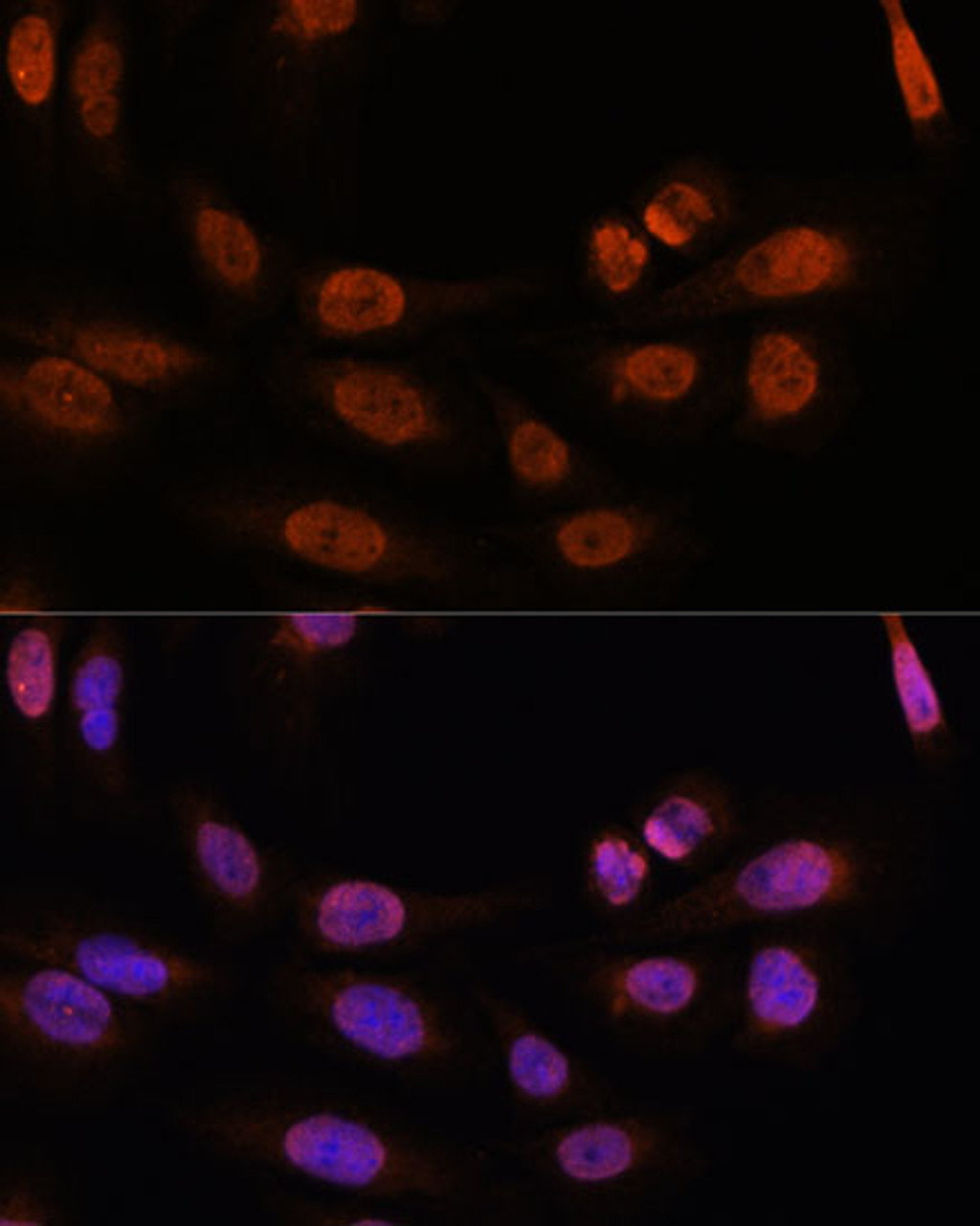 Immunofluorescence analysis of U-2 OS cells using THRB Polyclonal Antibody at dilution of  1:100. Blue: DAPI for nuclear staining.