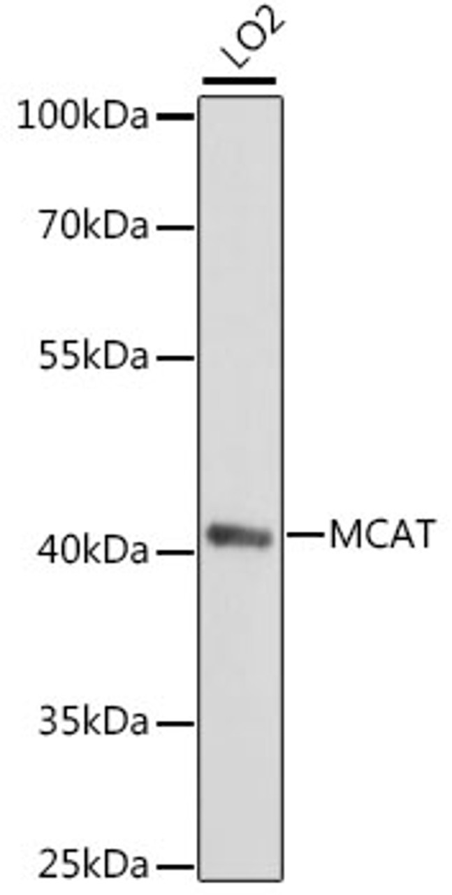Western blot analysis of extracts of LO2 cells using MCAT Polyclonal Antibody at dilution of 1:1000.