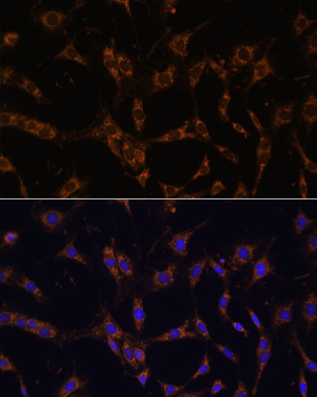 Immunofluorescence analysis of C6 cells using UBE2J1 Polyclonal Antibody at dilution of  1:100. Blue: DAPI for nuclear staining.
