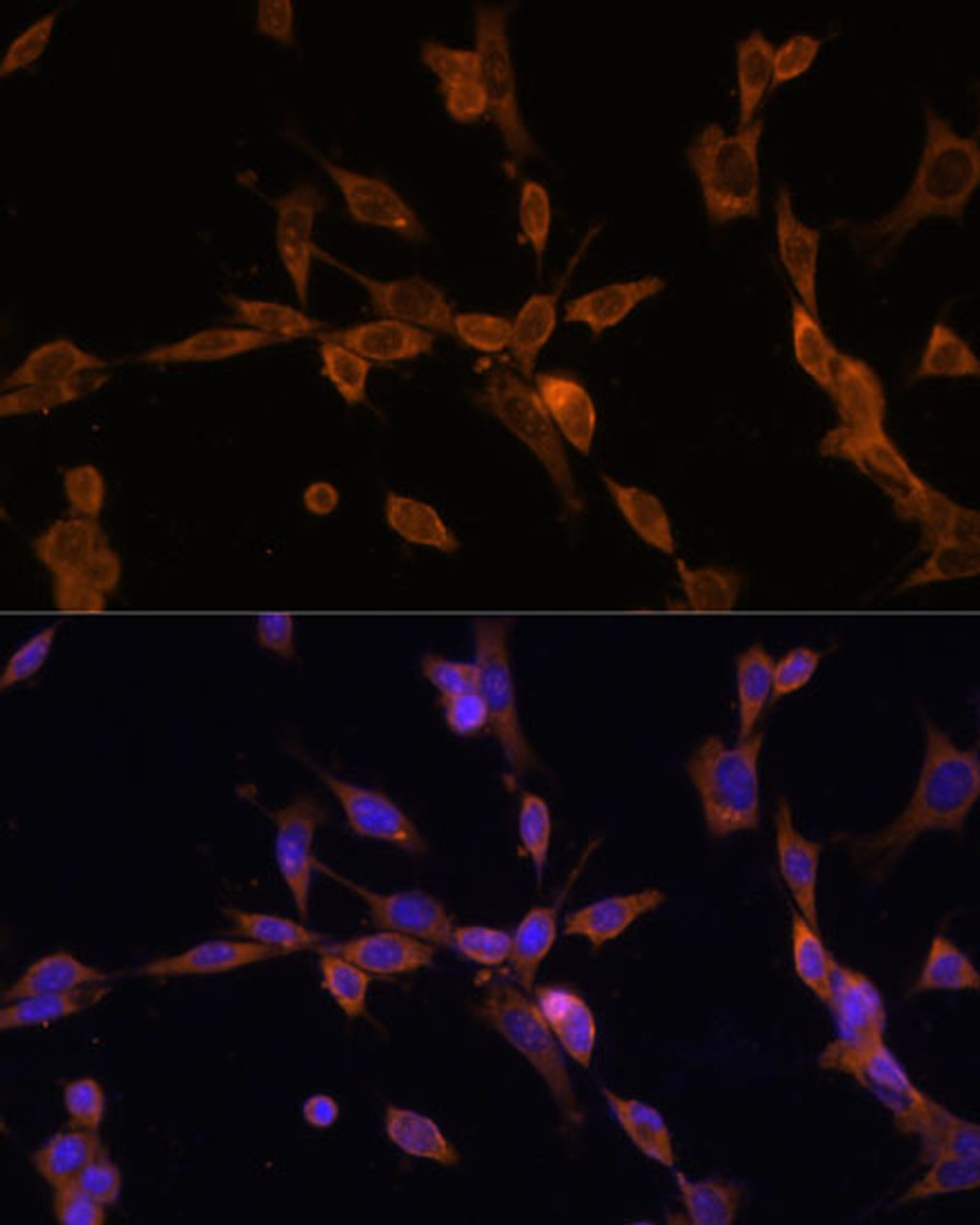 Immunofluorescence analysis of NIH/3T3 cells using UBE2J1 Polyclonal Antibody at dilution of  1:100. Blue: DAPI for nuclear staining.