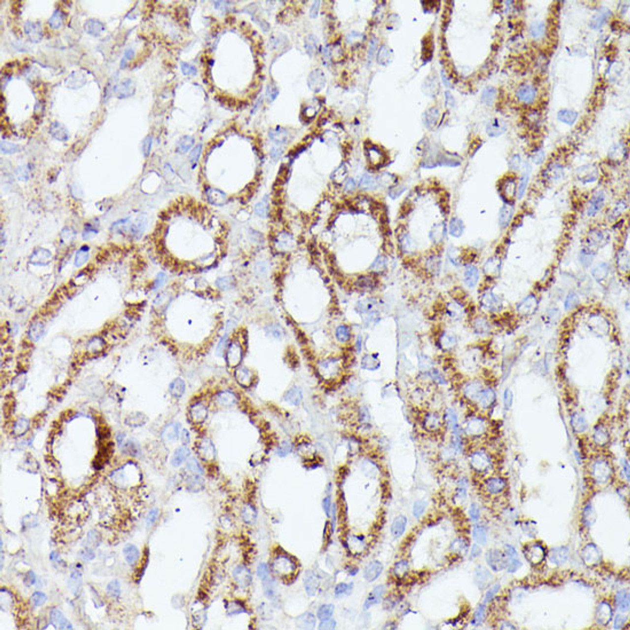 Immunohistochemistry of paraffin-embedded Mouse kidney using CDK5RAP1 Polyclonal Antibody at dilution of  1:100 (40x lens).