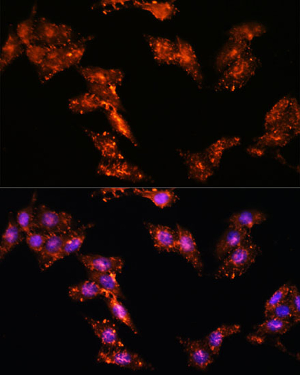 Immunofluorescence analysis of HeLa cells using CDK5RAP1 Polyclonal Antibody at dilution of  1:100. Blue: DAPI for nuclear staining.
