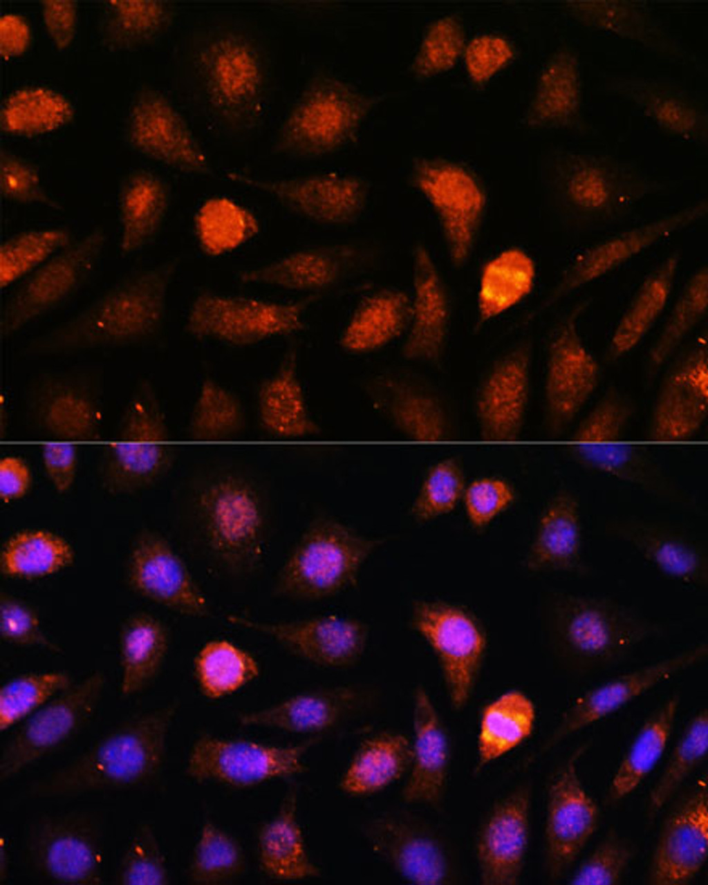 Immunofluorescence analysis of L-929 cells using CDK5RAP1 Polyclonal Antibody at dilution of  1:100. Blue: DAPI for nuclear staining.