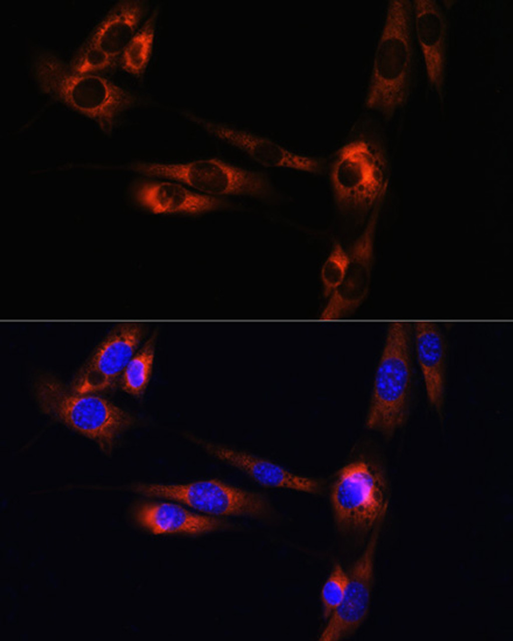 Immunofluorescence analysis of NIH/3T3 cells using ADORA2A Polyclonal Antibody at dilution of  1:100. Blue: DAPI for nuclear staining.