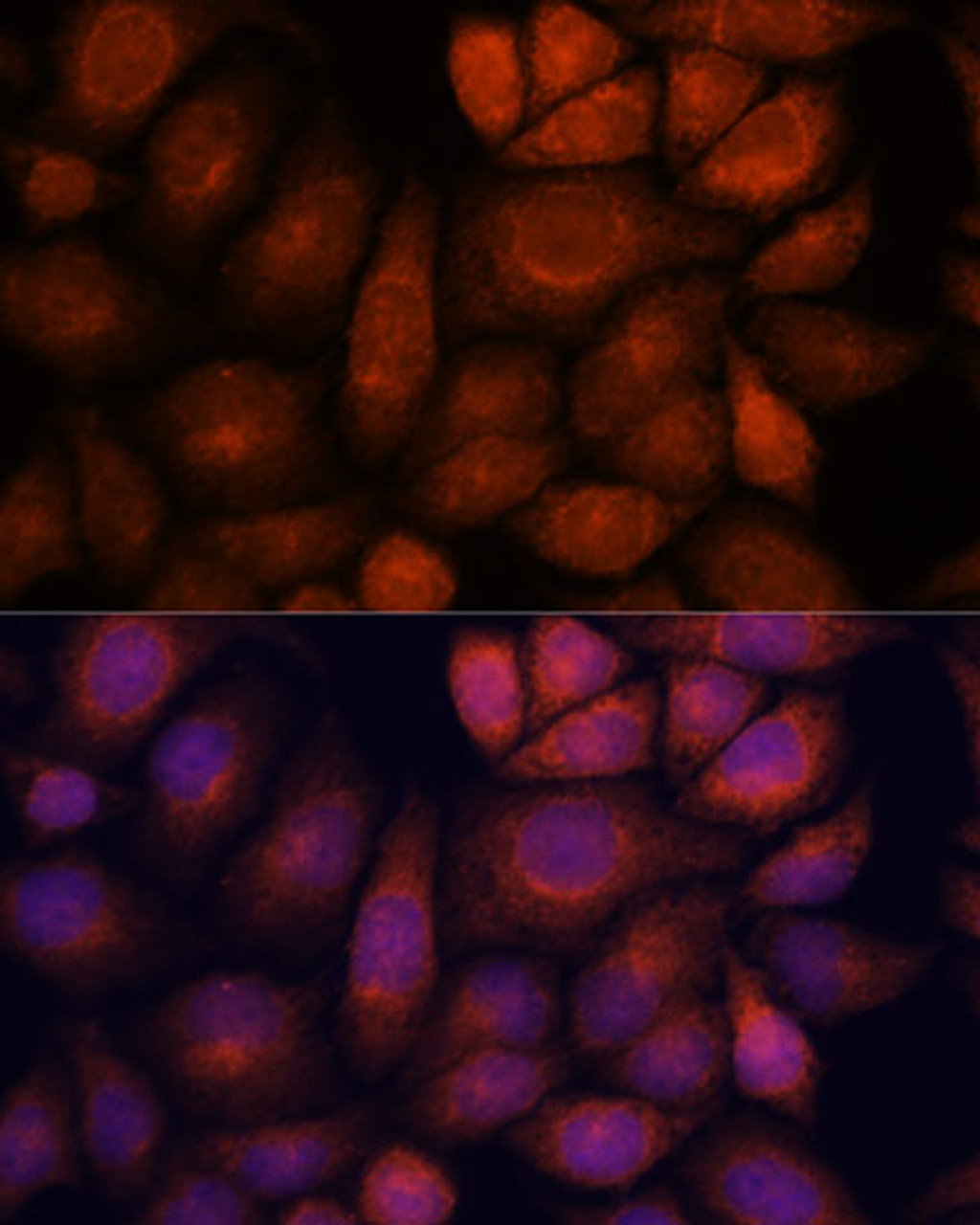 Immunofluorescence analysis of HeLa cells using KIF13A Polyclonal Antibody at dilution of  1:100. Blue: DAPI for nuclear staining.