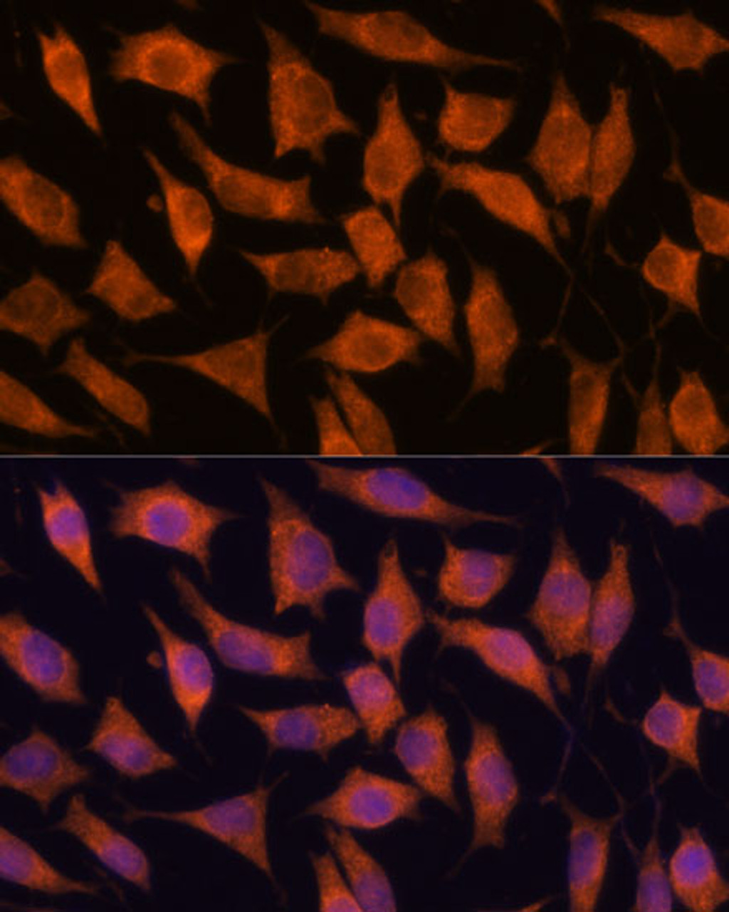 Immunofluorescence analysis of L929 cells using KIF13A Polyclonal Antibody at dilution of  1:100. Blue: DAPI for nuclear staining.