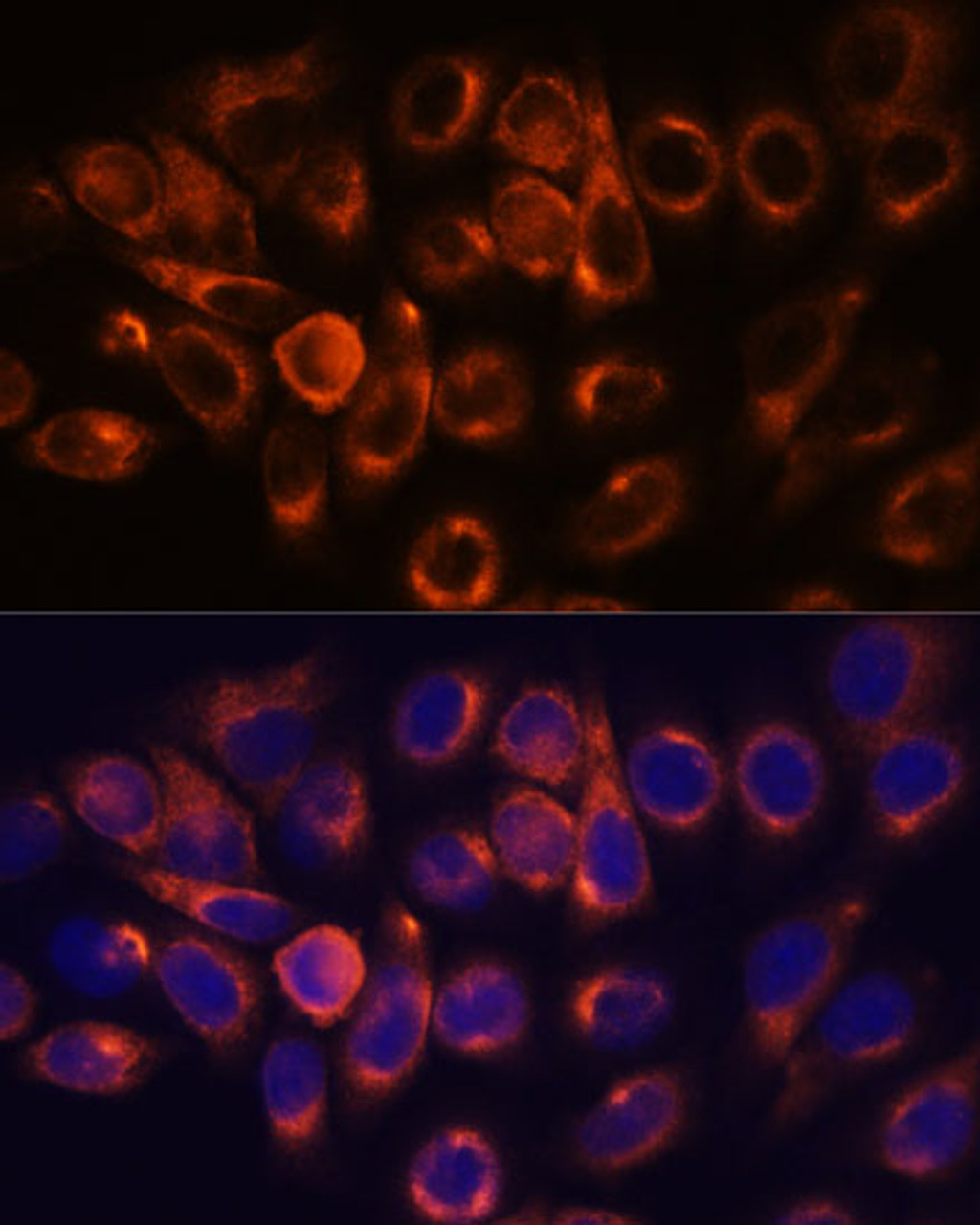 Immunofluorescence analysis of HeLa cells using ATL2 Polyclonal Antibody at dilution of  1:100. Blue: DAPI for nuclear staining.