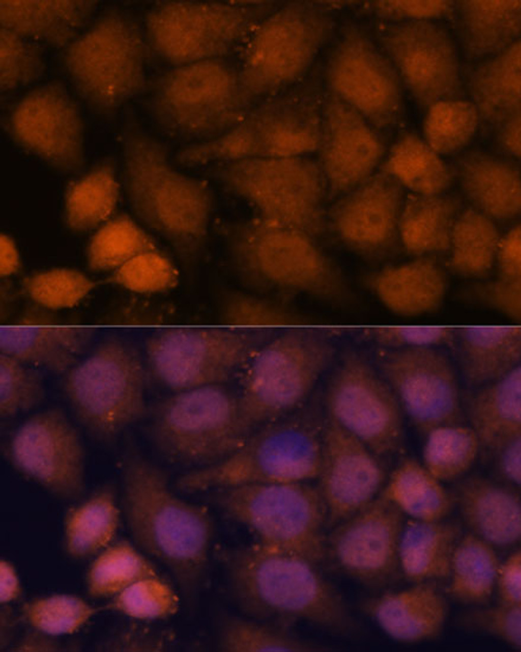 Immunofluorescence analysis of HeLa cells using CEP85 Polyclonal Antibody at dilution of  1:100. Blue: DAPI for nuclear staining.