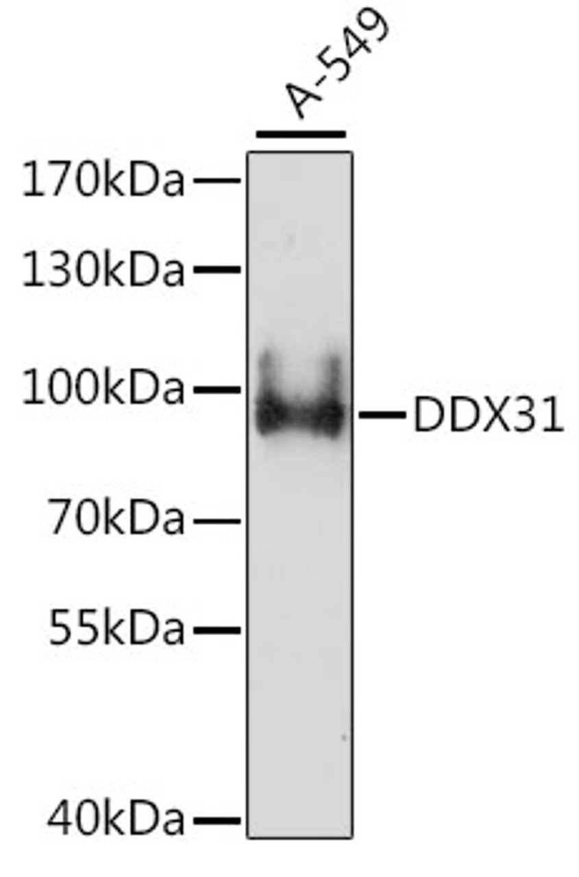 Western blot analysis of extracts of A-549 cells using DDX31 Polyclonal Antibody at dilution of 1:1000.