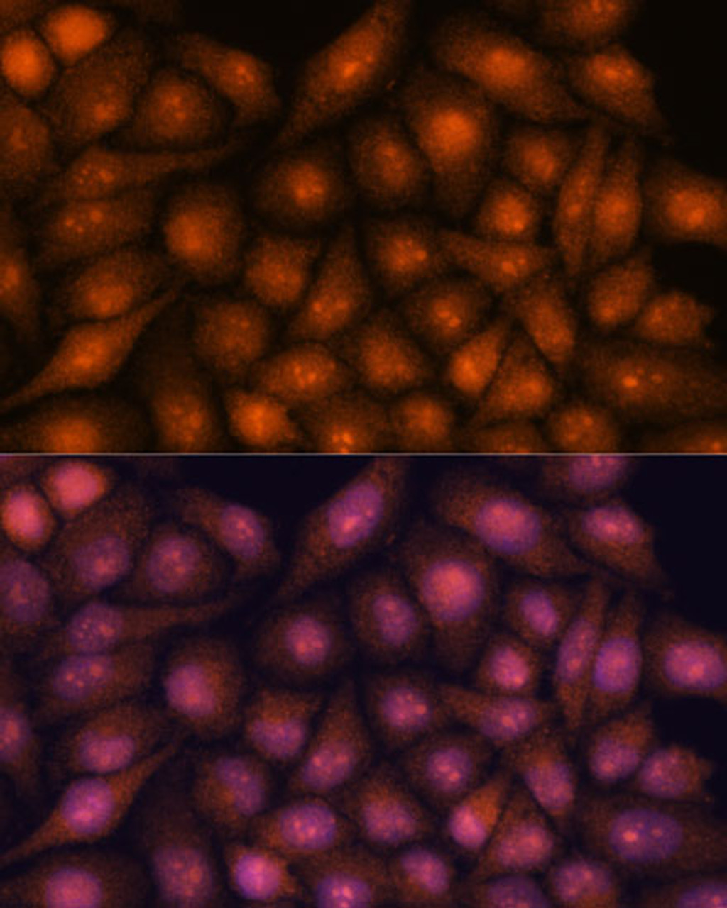 Immunofluorescence analysis of HeLa cells using DDX31 Polyclonal Antibody at dilution of  1:100. Blue: DAPI for nuclear staining.