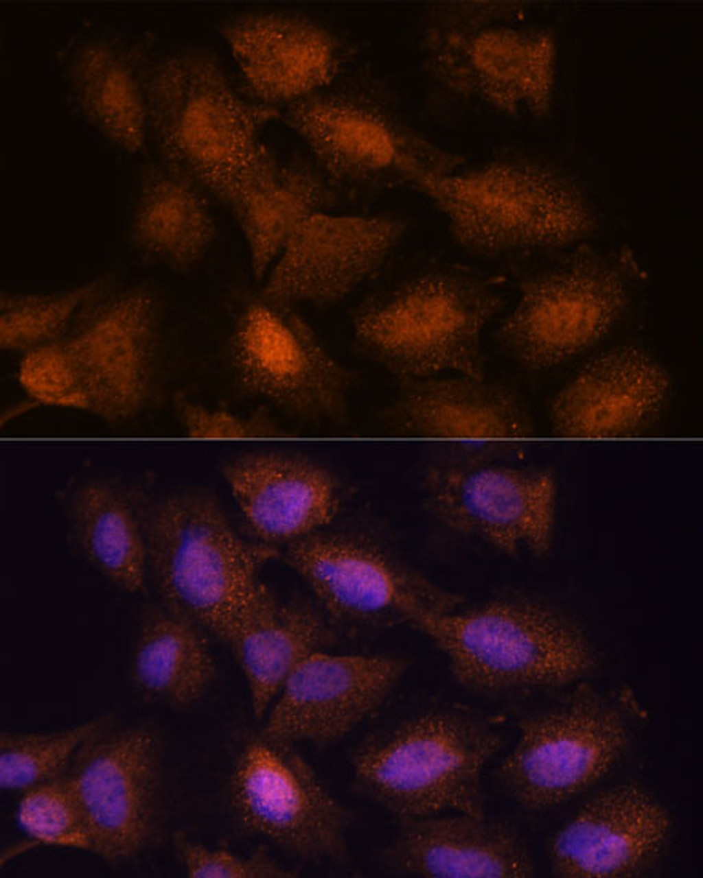 Immunofluorescence analysis of C6 cells using UPF3A Polyclonal Antibody at dilution of  1:100. Blue: DAPI for nuclear staining.