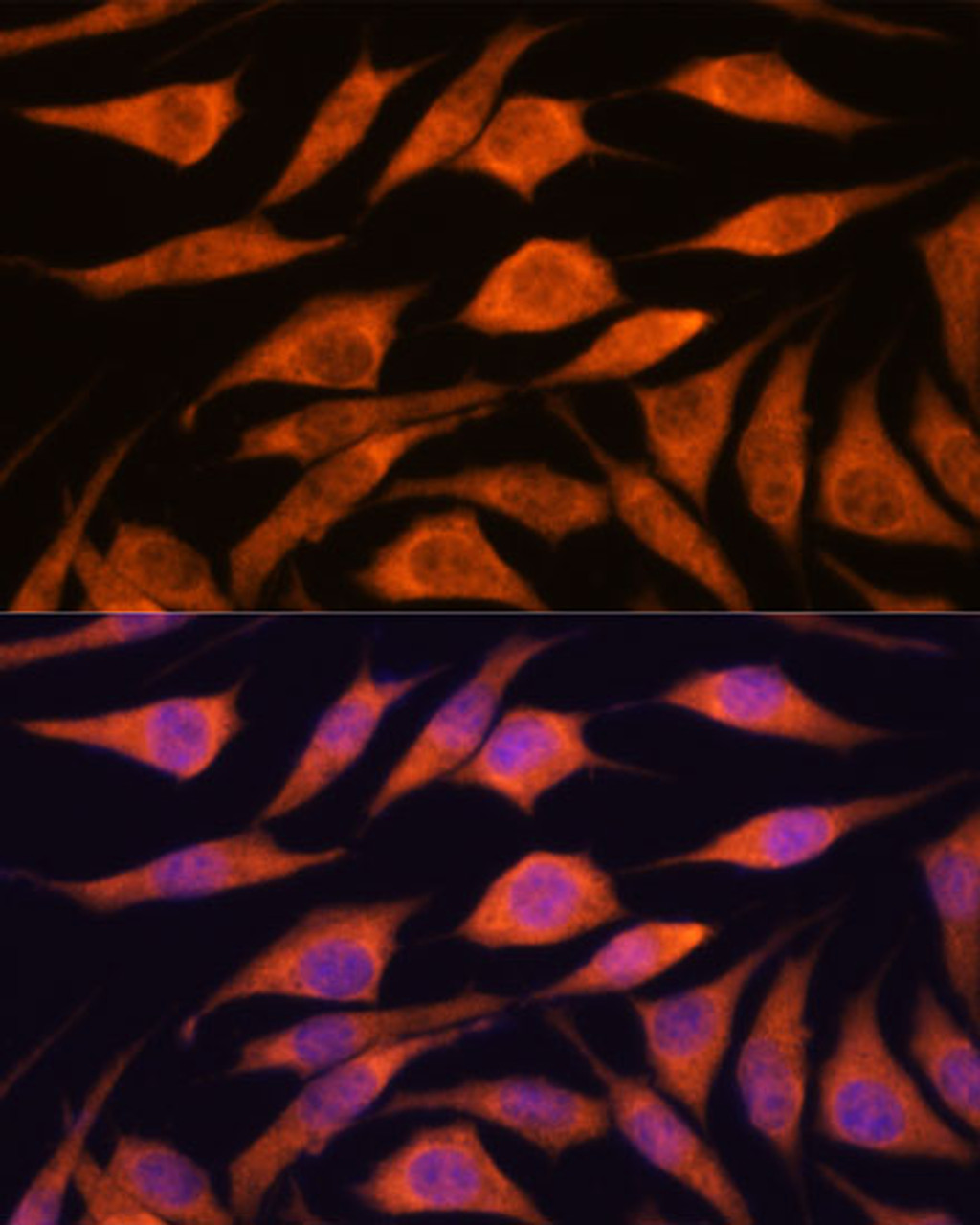 Immunofluorescence analysis of L929 cells using UPF3A Polyclonal Antibody at dilution of  1:100. Blue: DAPI for nuclear staining.