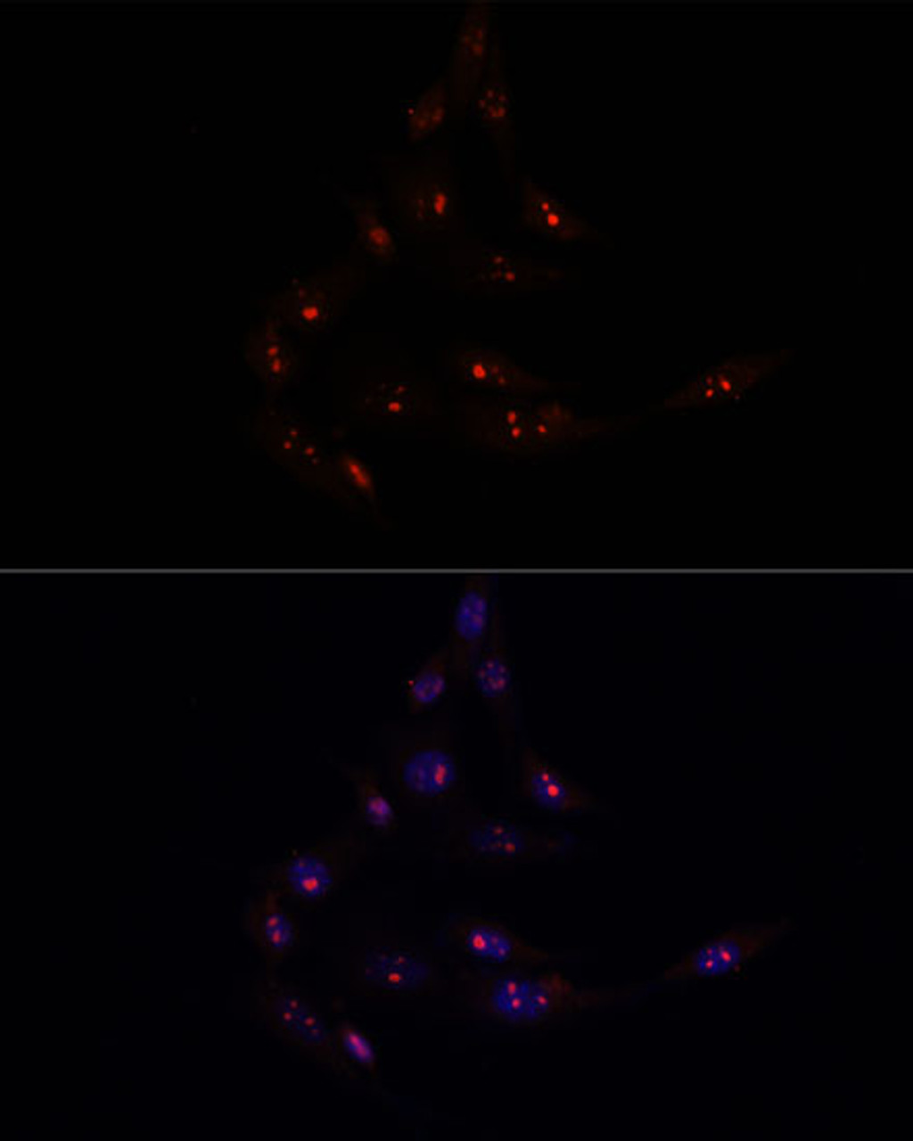 Immunofluorescence analysis of NIH/3T3 cells using METTL16 Polyclonal Antibody at dilution of  1:100. Blue: DAPI for nuclear staining.