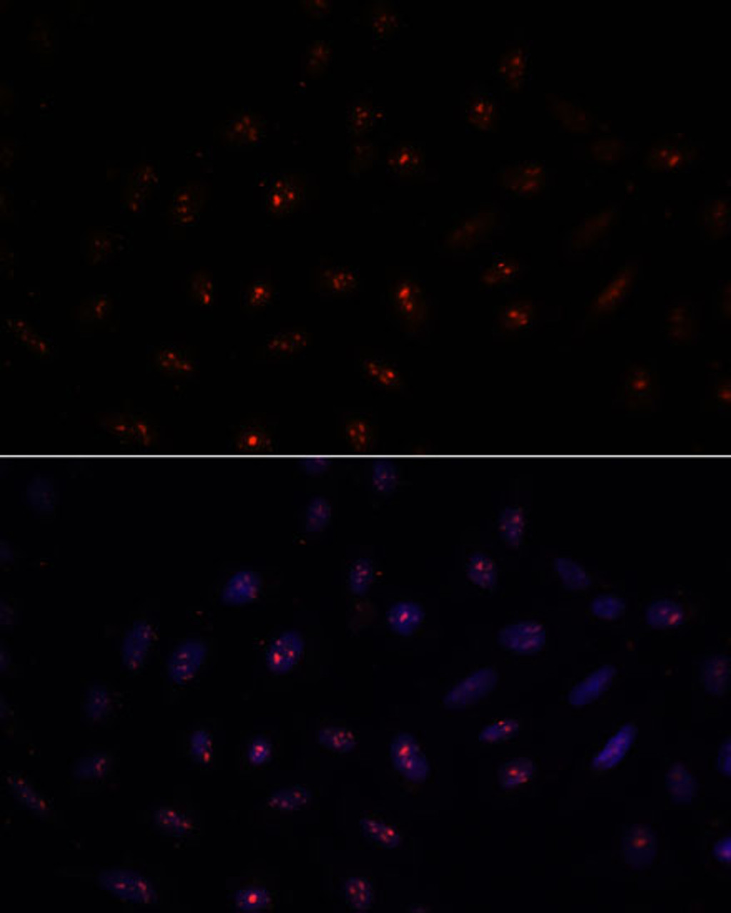 Immunofluorescence analysis of U-2 OS cells using METTL16 Polyclonal Antibody at dilution of  1:100. Blue: DAPI for nuclear staining.