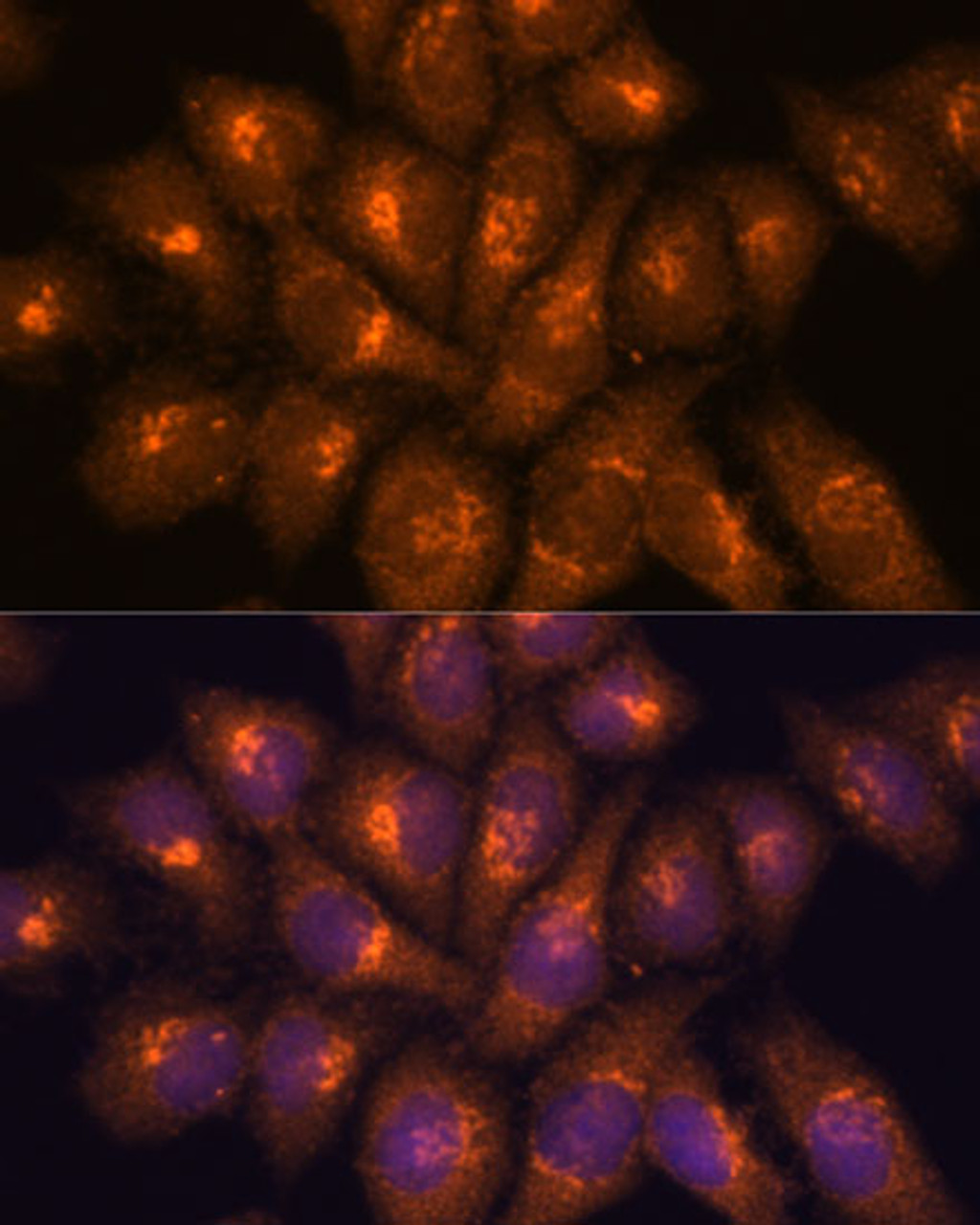 Immunofluorescence analysis of HeLa cells using B3GNT4 Polyclonal Antibody at dilution of  1:100. Blue: DAPI for nuclear staining.