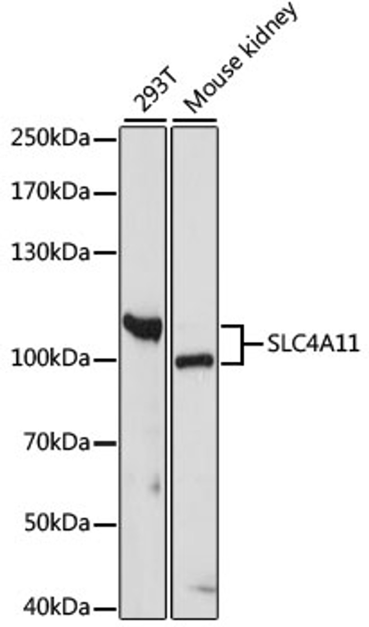 Western blot analysis of extracts of various cell lines using SLC4A11 Polyclonal Antibody at dilution of 1:1000.