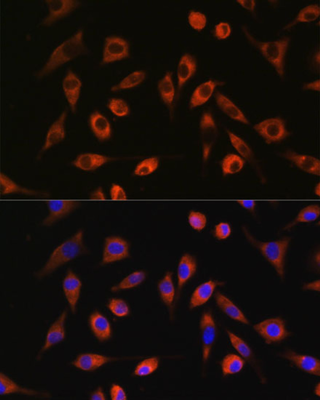 Immunofluorescence analysis of L929 cells using TP53I13 Polyclonal Antibody at dilution of  1:100. Blue: DAPI for nuclear staining.