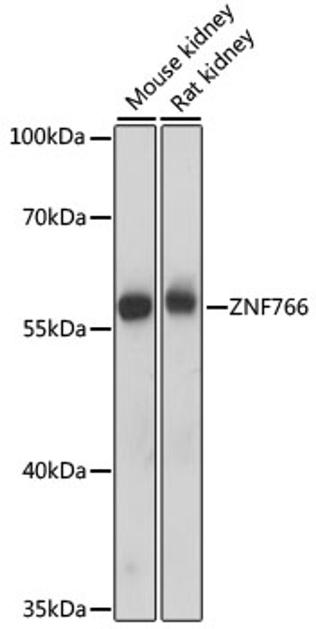 Western blot analysis of extracts of various cell lines using ZNF766 Polyclonal Antibody at dilution of 1:1000.