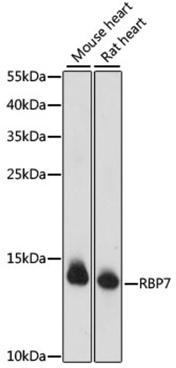 Western blot analysis of extracts of various cell lines using RBP7 Polyclonal Antibody at dilution of 1:1000.