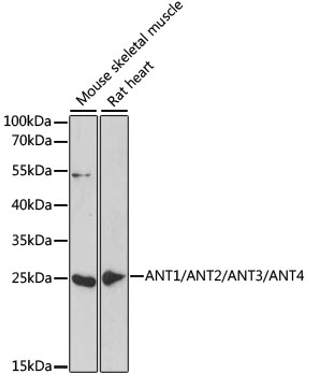 Western blot analysis of extracts of various cell lines using ANT1/ANT2/ANT3/ANT4 Polyclonal Antibody at dilution of 1:1000.