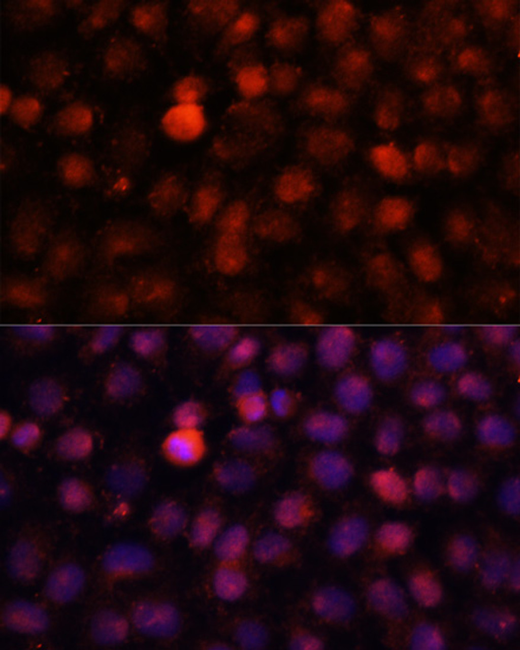 Immunofluorescence analysis of HeLa cells using N4-Methylcytidine Polyclonal Antibody at dilution of  1:100 (40x lens). Blue: DAPI for nuclear staining.