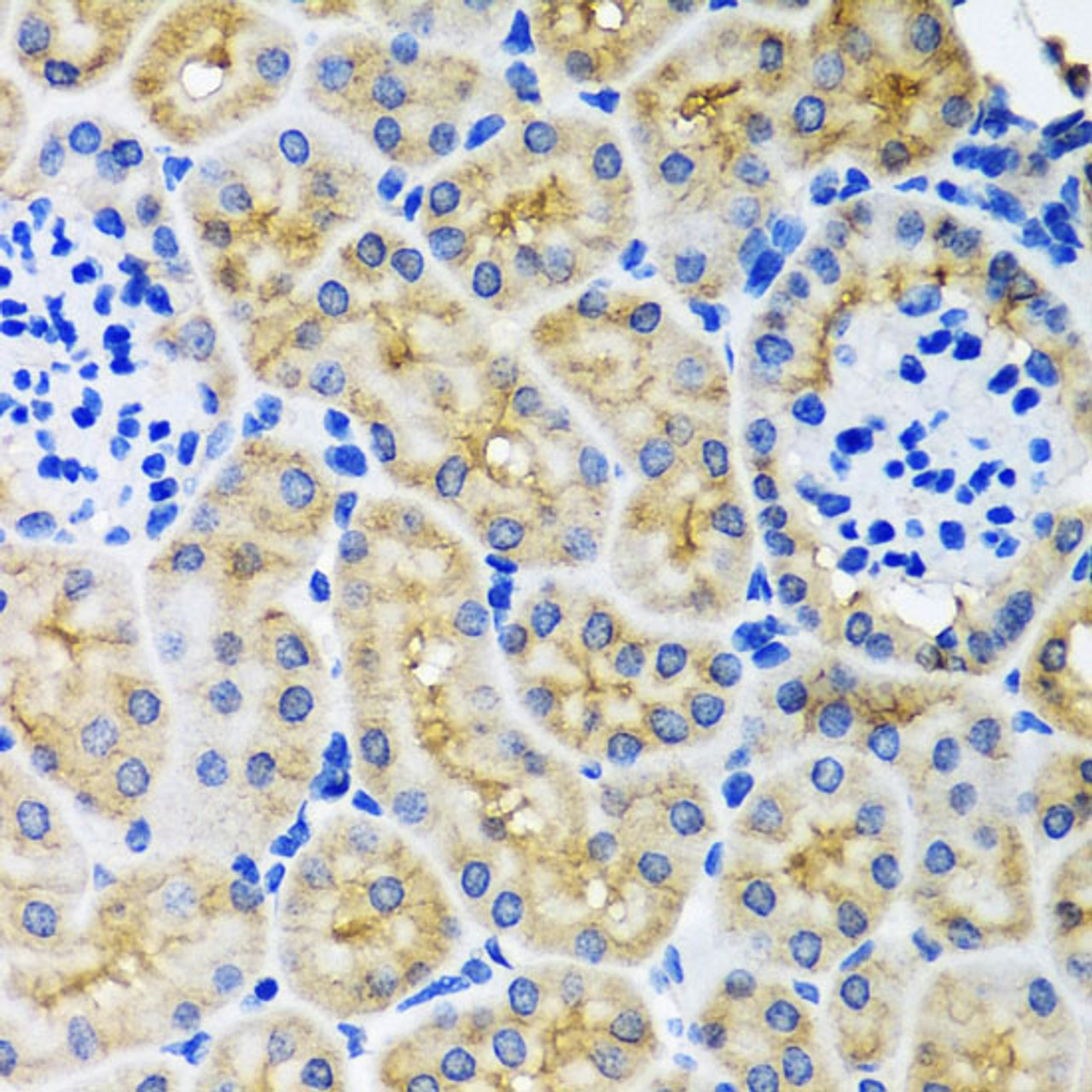 Immunohistochemistry of paraffin-embedded Mouse kidney using SULT1A1 Polyclonal Antibody at dilution of  1:100 (40x lens).