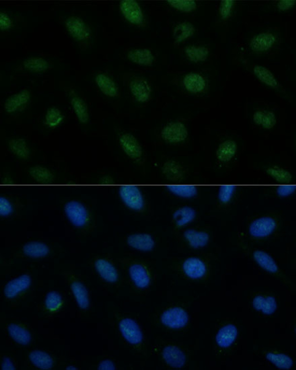 Immunofluorescence analysis of U-2 OS cells using CENPA Polyclonal Antibody at dilution of  1:100 (40x lens). Blue: DAPI for nuclear staining.