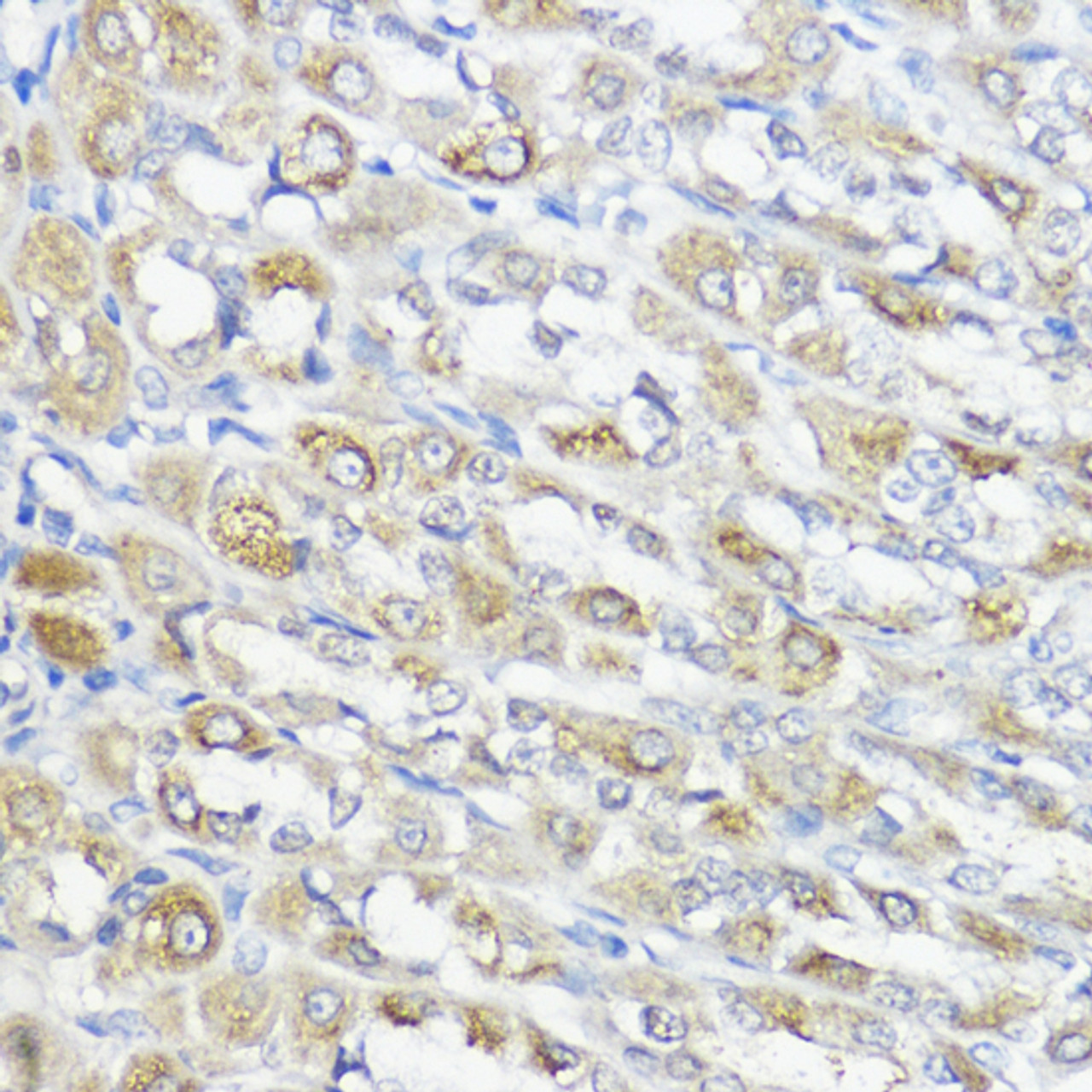 Immunohistochemistry of paraffin-embedded Rat stomach using GPX2 Polyclonal Antibody at dilution of  1:100 (40x lens).