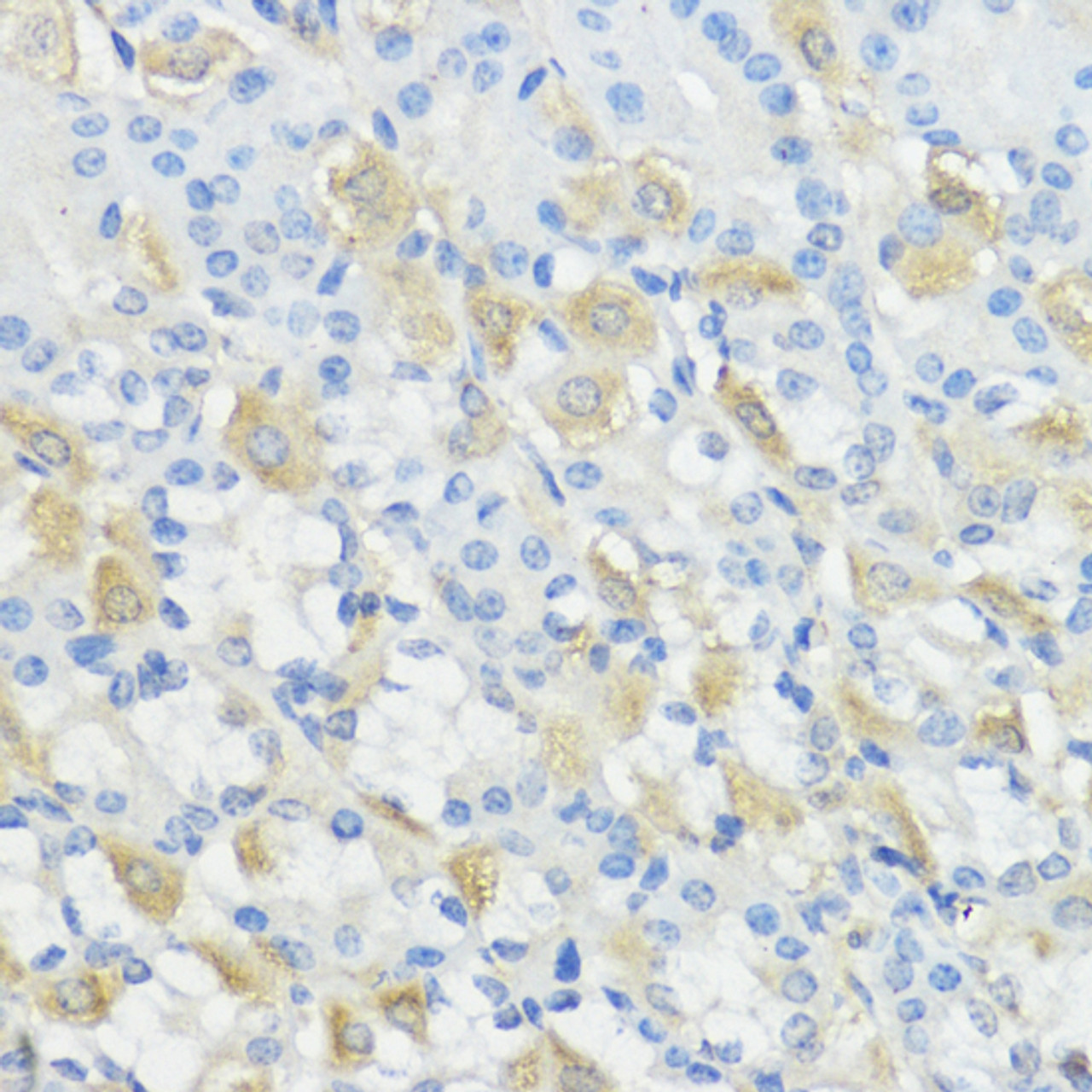 Immunohistochemistry of paraffin-embedded Mouse stomach using GPX2 Polyclonal Antibody at dilution of  1:100 (40x lens).