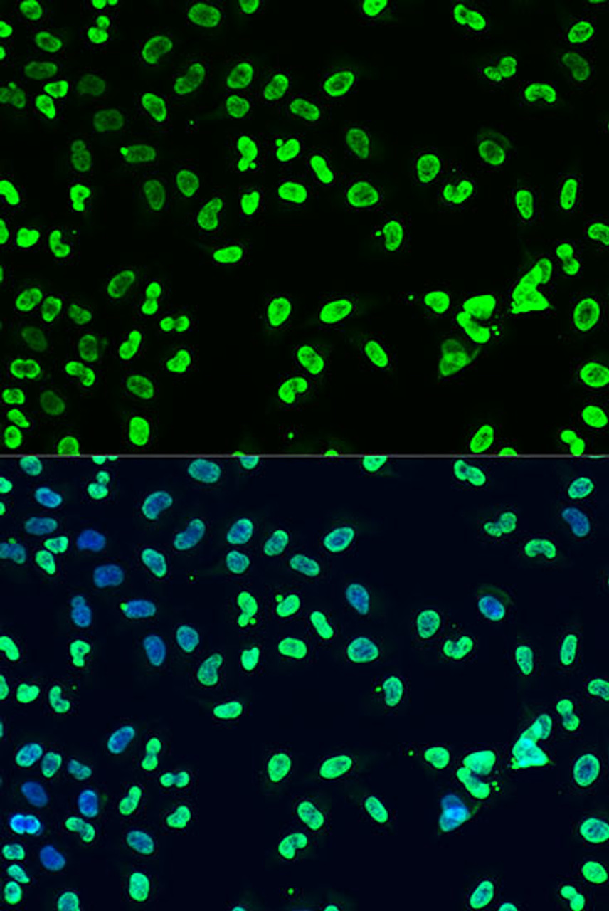 Immunofluorescence analysis of U2OS cells using DiMethyl-DNMT3A-K44 Polyclonal Antibody at dilution of  1:100. Blue: DAPI for nuclear staining.