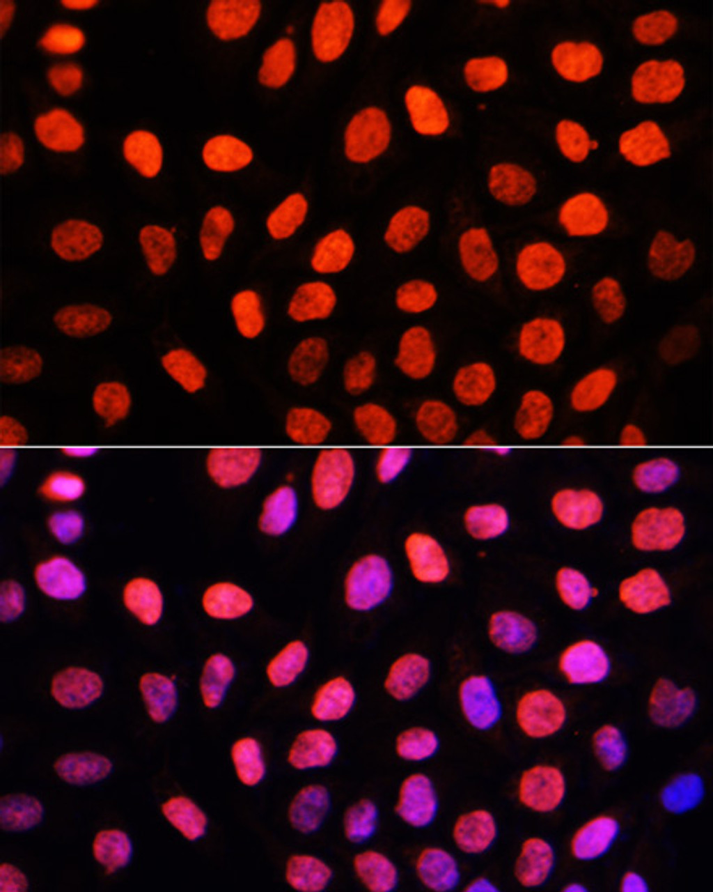 Immunofluorescence analysis of HeLa cells using DiMethyl-DNMT3A-K44 Polyclonal Antibody at dilution of  1:100. Blue: DAPI for nuclear staining.