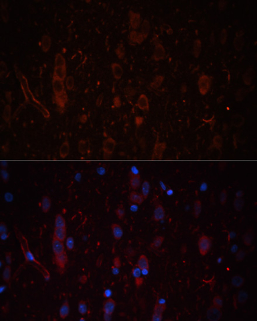 Immunofluorescence analysis of Rat brain using LAMC1 Polyclonal Antibody at dilution of  1:100. Blue: DAPI for nuclear staining.