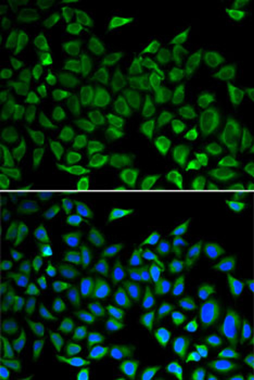 Immunofluorescence analysis of A-549 cells using CDC45 Polyclonal Antibody