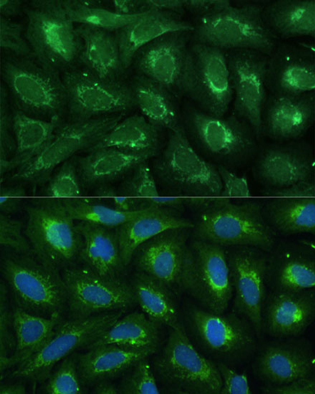 Immunofluorescence analysis of U-2 OS cells using ABCD2 Polyclonal Antibody at dilution of  1:100 (40x lens). Blue: DAPI for nuclear staining.