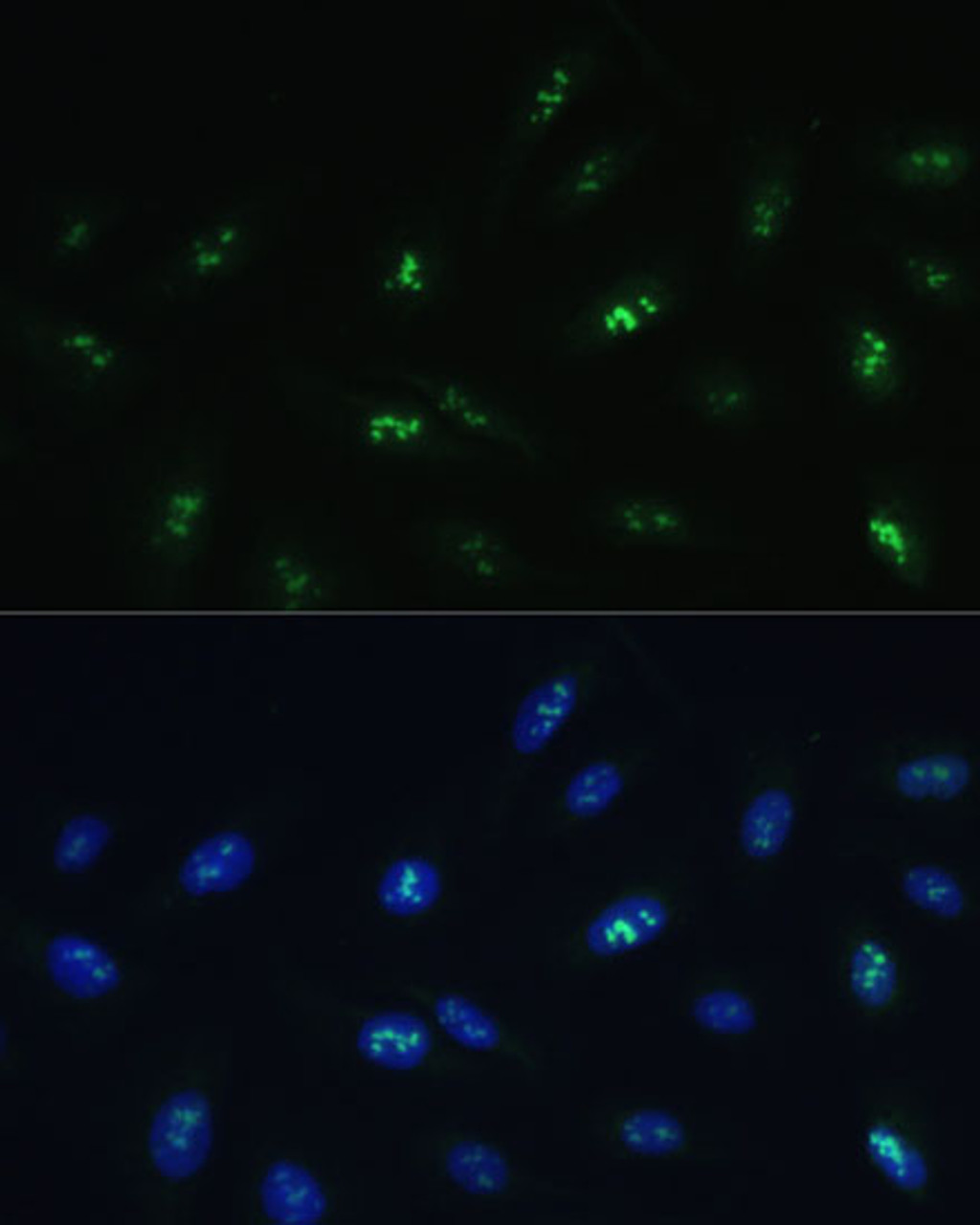 Immunofluorescence analysis of U-2 OS cells using HNF4G Polyclonal Antibody at dilution of  1:100 (40x lens). Blue: DAPI for nuclear staining.