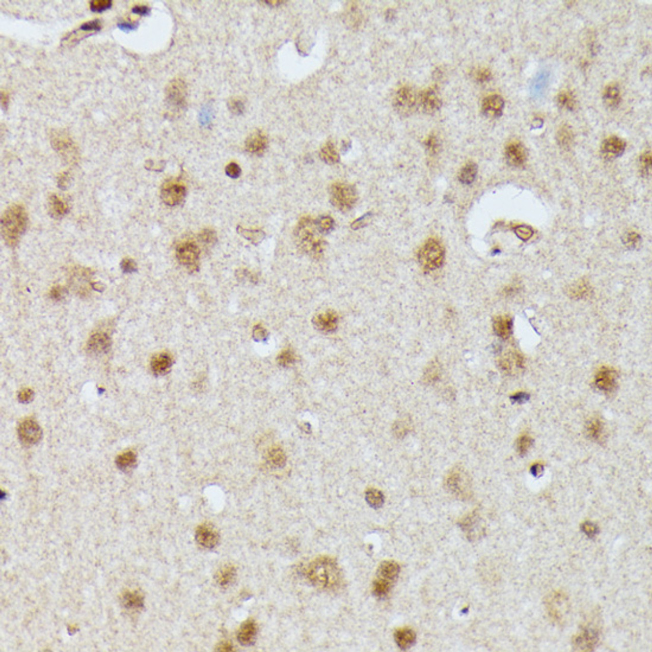 Immunohistochemistry of paraffin-embedded Rat brain using IGHMBP2 Polyclonal Antibody at dilution of  1:100 (40x lens).