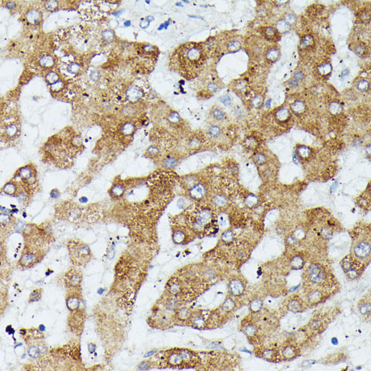 Immunohistochemistry of paraffin-embedded Human liver using MAP3K1 Polyclonal Antibody at dilution of  1:100 (40x lens).