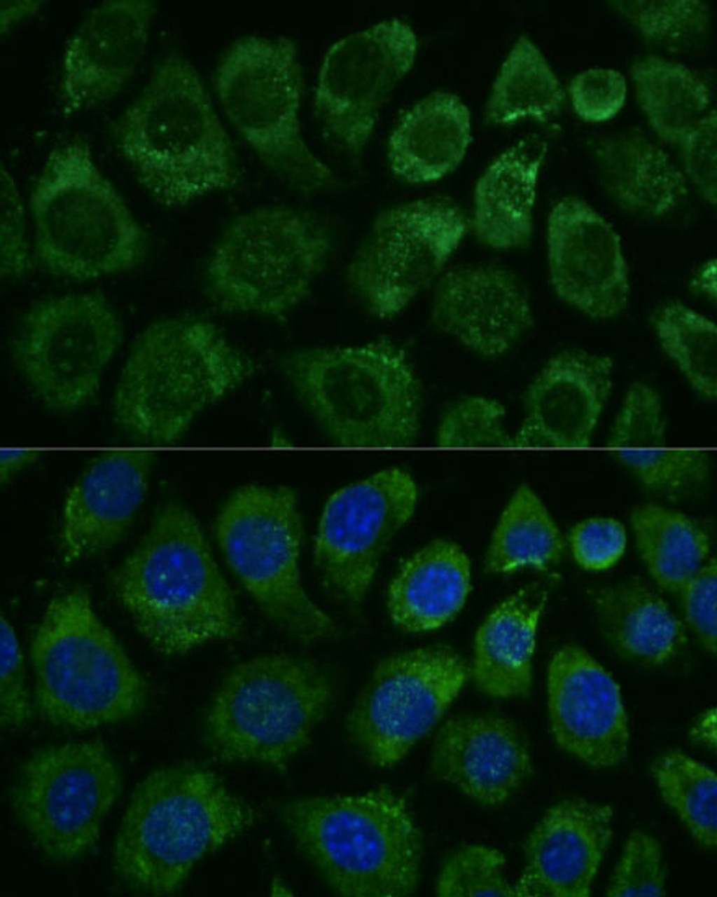 Immunofluorescence analysis of L929 cells using MAP3K1 Polyclonal Antibody at dilution of  1:100 (40x lens). Blue: DAPI for nuclear staining.