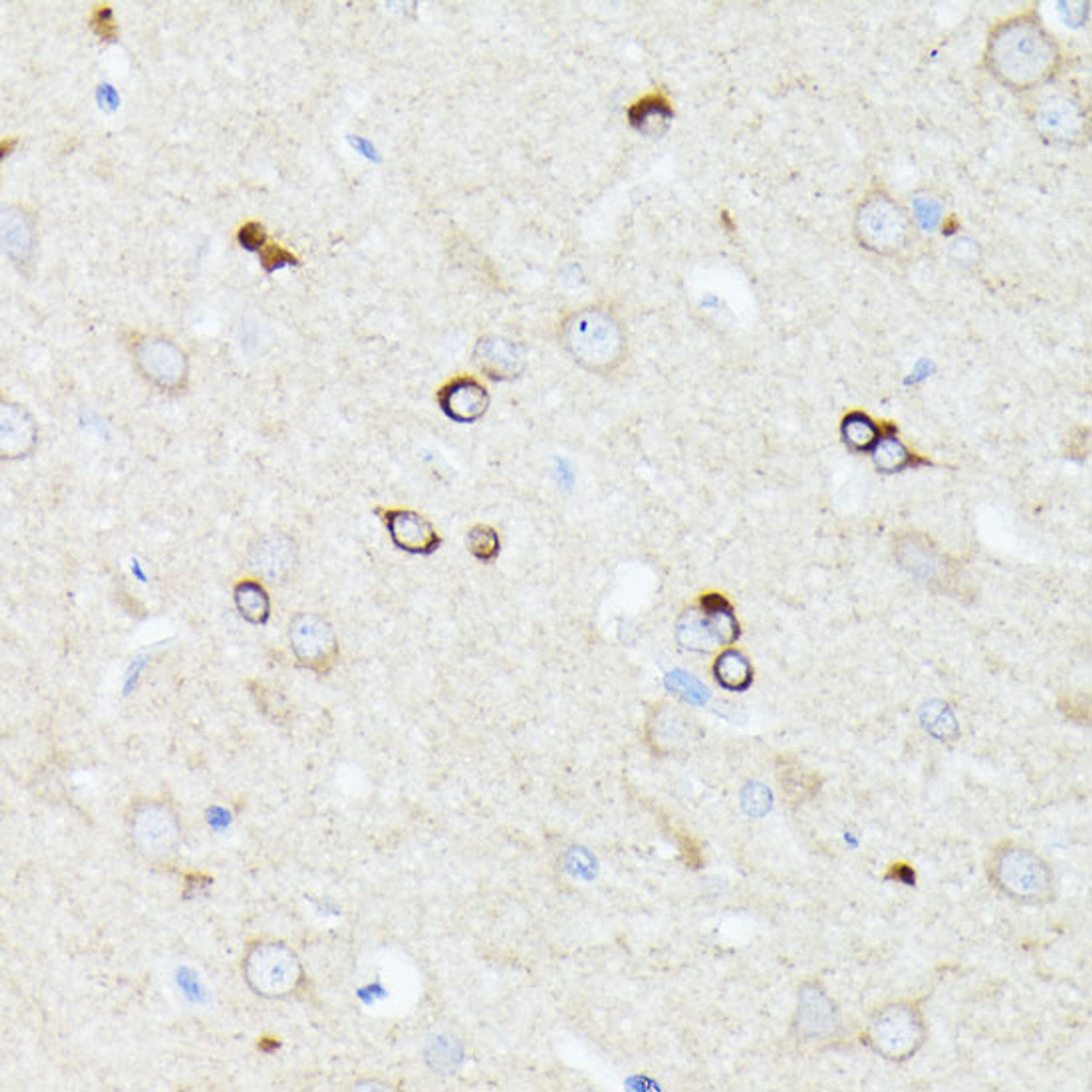 Immunohistochemistry of paraffin-embedded Rat brain using CCDC6 Polyclonal Antibody at dilution of  1:100 (40x lens).