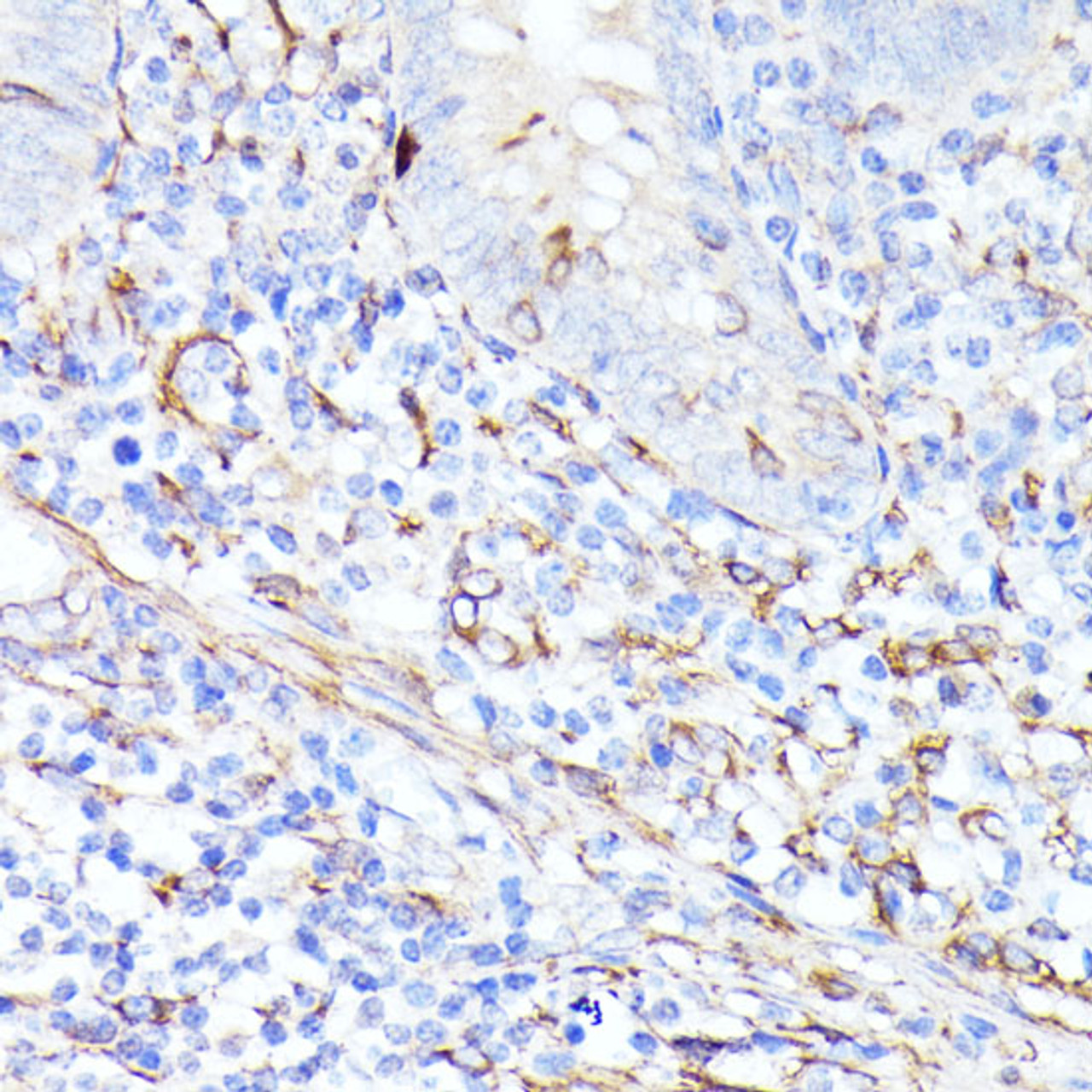 Immunohistochemistry of paraffin-embedded Human appendix using CCDC6 Polyclonal Antibody at dilution of  1:100 (40x lens).