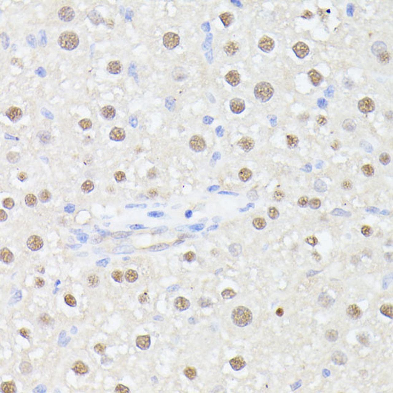 Immunohistochemistry of paraffin-embedded Rat liver using MLF2 Polyclonal Antibody at dilution of  1:100 (40x lens).