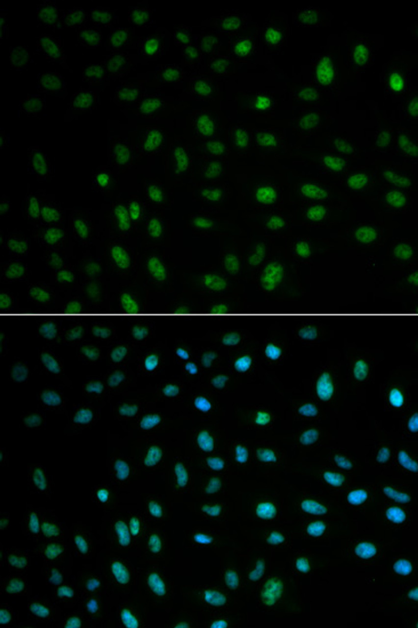 Immunofluorescence analysis of MCF-7 cells using HuR / ELAVL1 Polyclonal Antibody