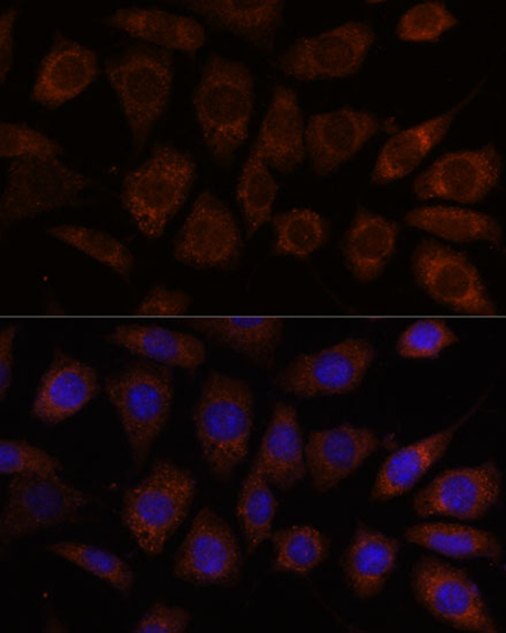 Immunofluorescence analysis of L929 cells using SEC24D Polyclonal Antibody at dilution of  1:100. Blue: DAPI for nuclear staining.