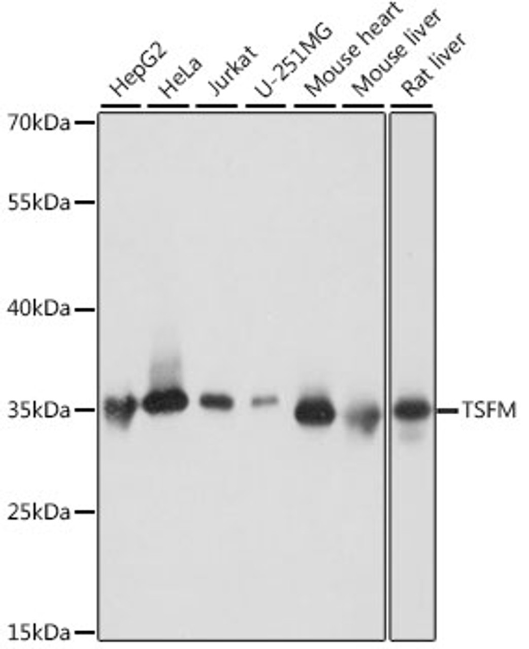 Western blot analysis of extracts of various cell lines using TSFM Polyclonal Antibody at dilution of 1:1000.