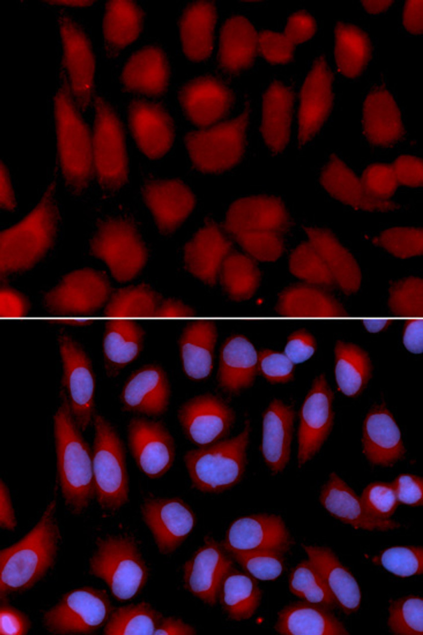 Immunofluorescence analysis of U2OS cells using TAP2 Polyclonal Antibody
