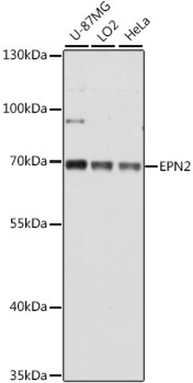 Western blot analysis of extracts of various cell lines using EPN2 Polyclonal Antibody at dilution of 1:1000.