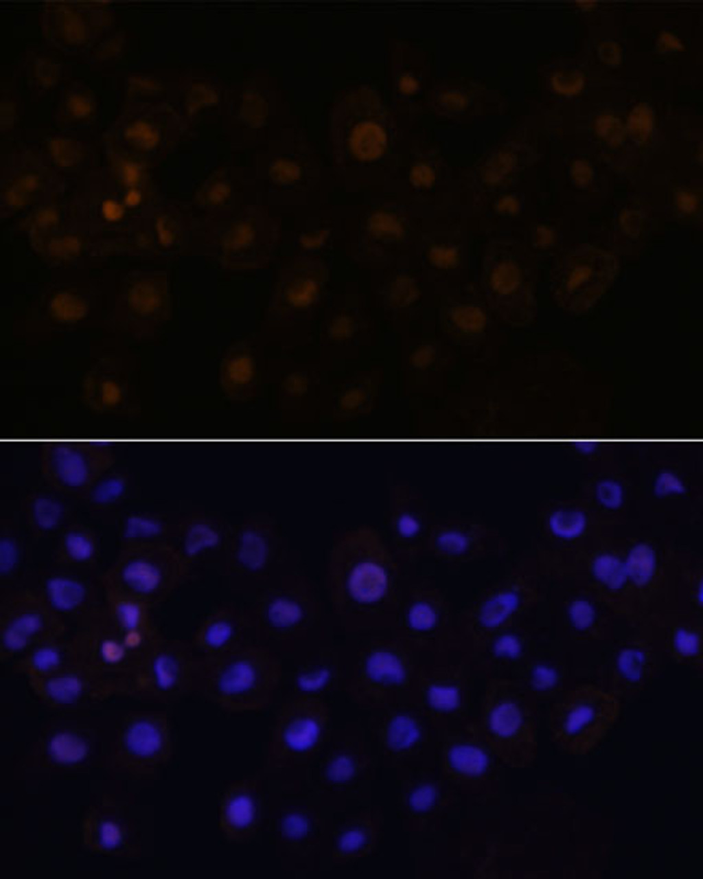 Immunofluorescence analysis of A431 cells using HEY1 Polyclonal Antibody at dilution of  1:100. Blue: DAPI for nuclear staining.