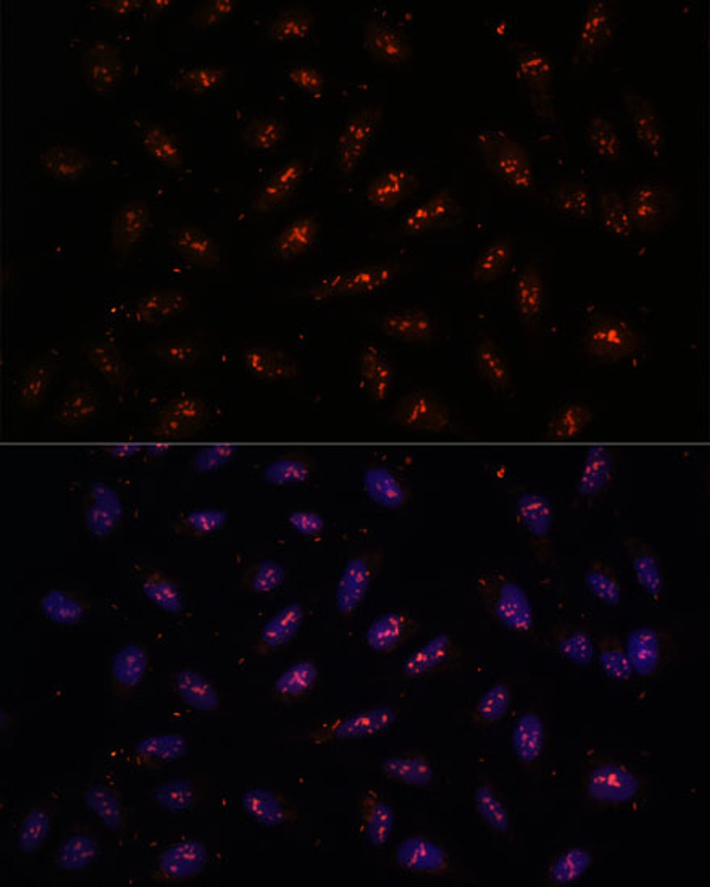 Immunofluorescence analysis of U-2 OS cells using DNTTIP2 Polyclonal Antibody at dilution of  1:100. Blue: DAPI for nuclear staining.