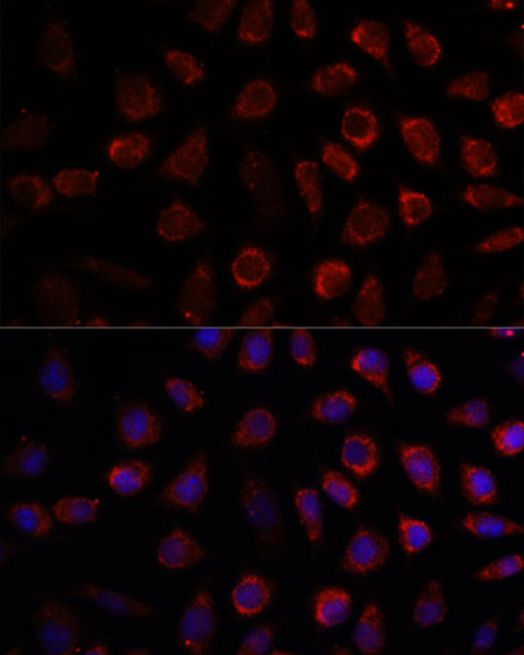 Immunofluorescence analysis of L929 cells using PDE11A Polyclonal Antibody at dilution of  1:100. Blue: DAPI for nuclear staining.