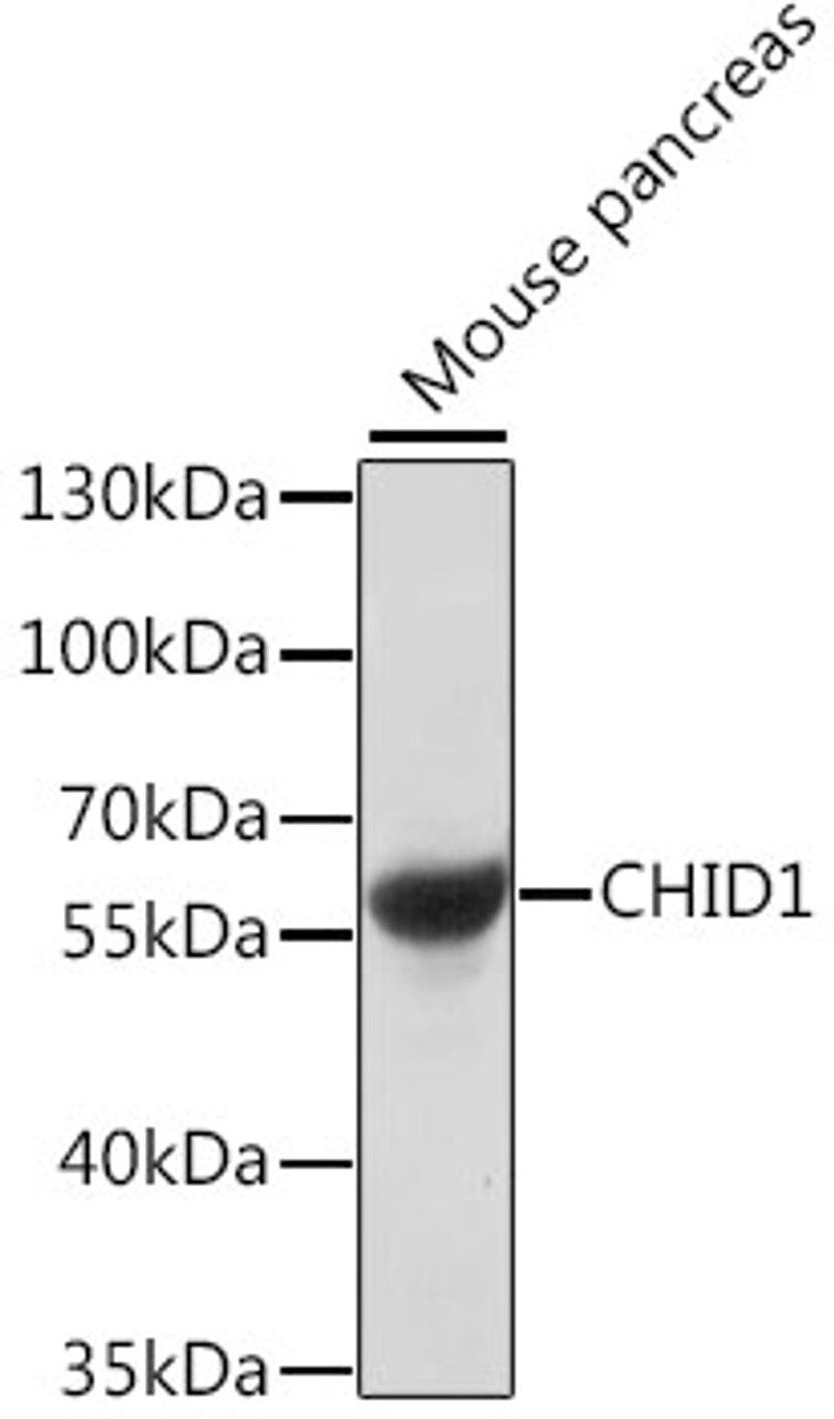 Western blot analysis of extracts of Mouse pancreas using CHID1 Polyclonal Antibody at dilution of 1:1000.